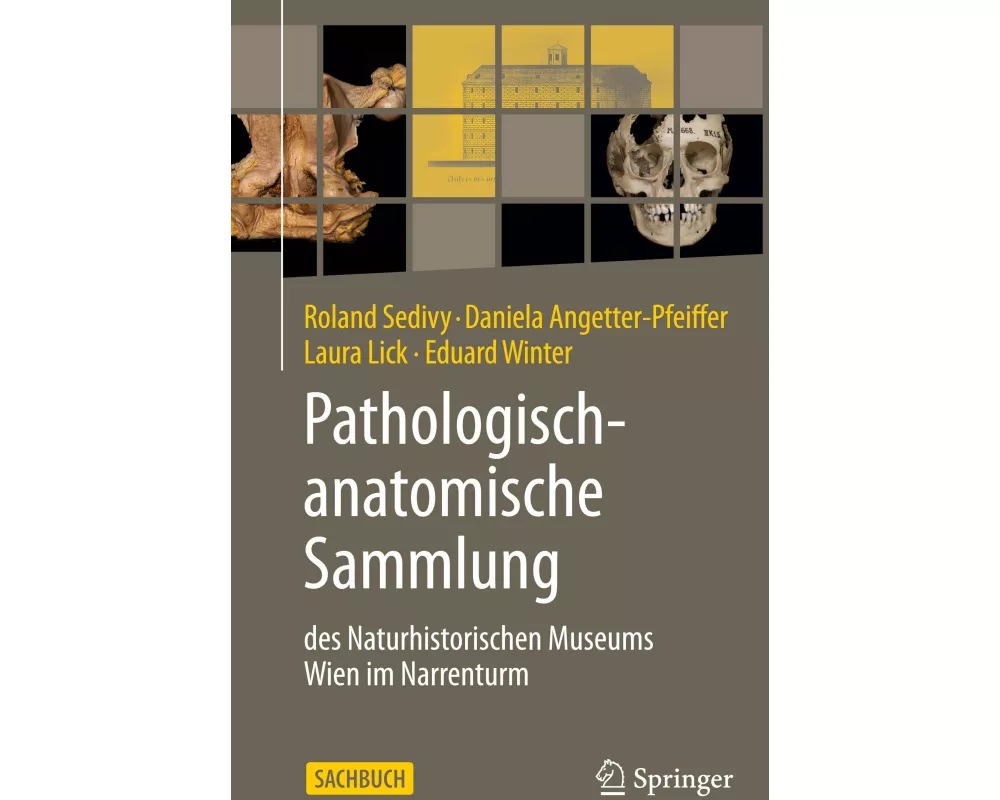 Pathologisch-anatomische Sammlung des Naturhistorischen Museums Wien im Narrenturm