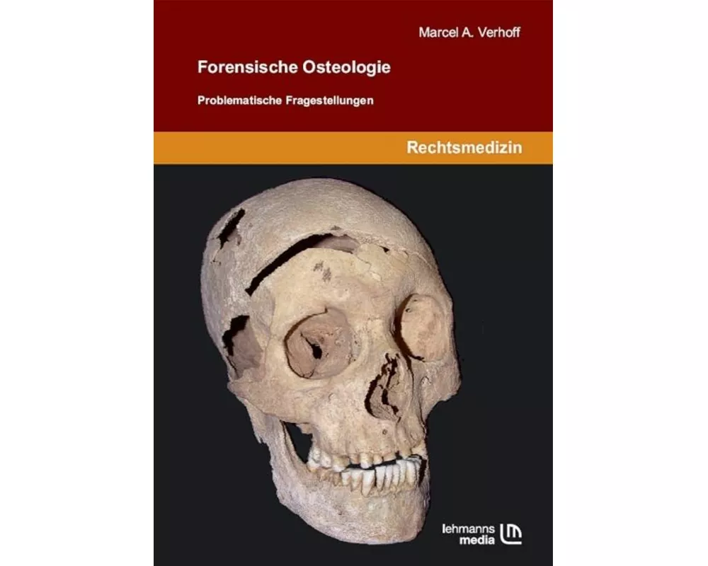 Forensische Osteologie