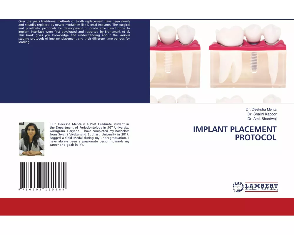 Implant Placement Protocol