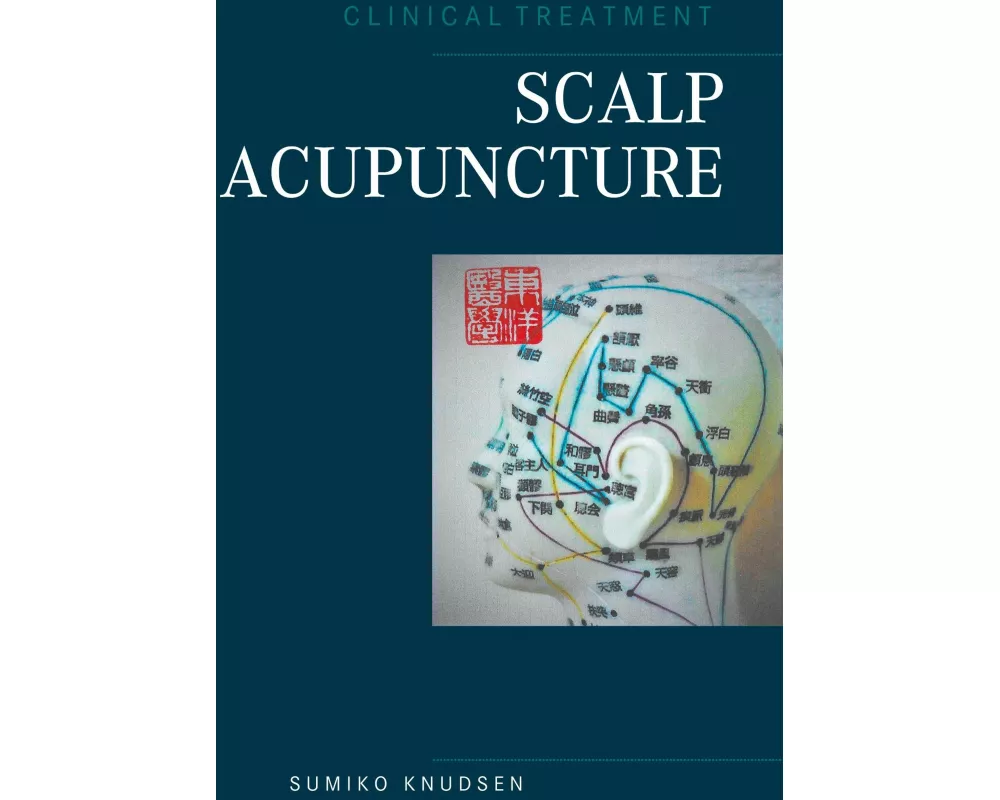 Scalp Acupuncture