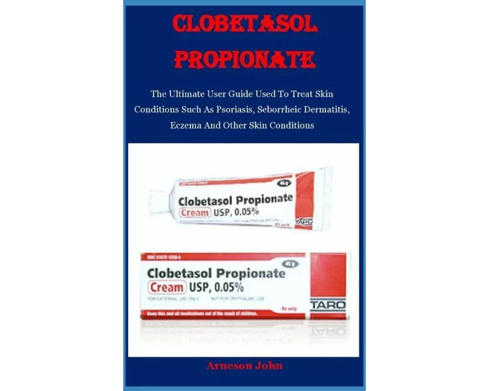 Clobetasol Propionate