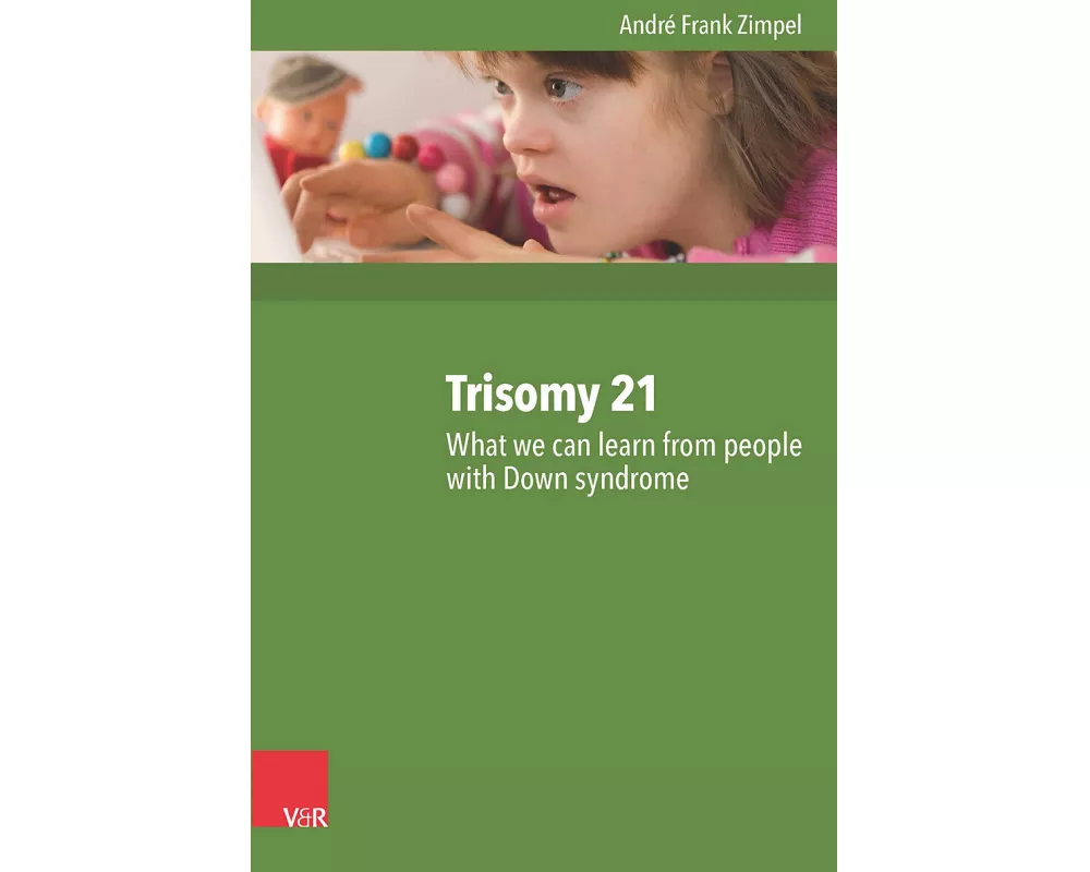 Trisomy 21