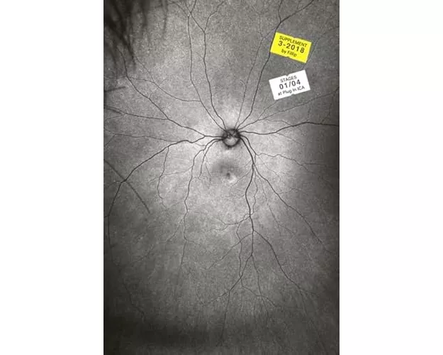 Supplement 3: The Invention and Conclusion of the Eye