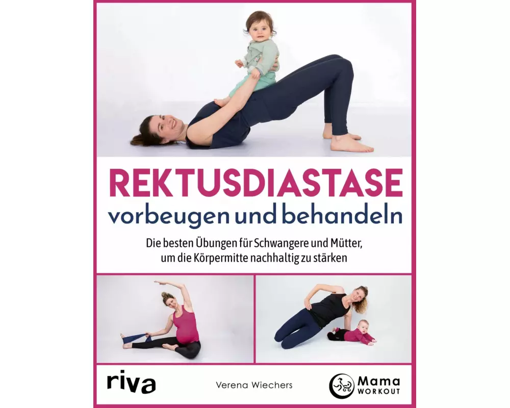 Rektusdiastase vorbeugen und behandeln
