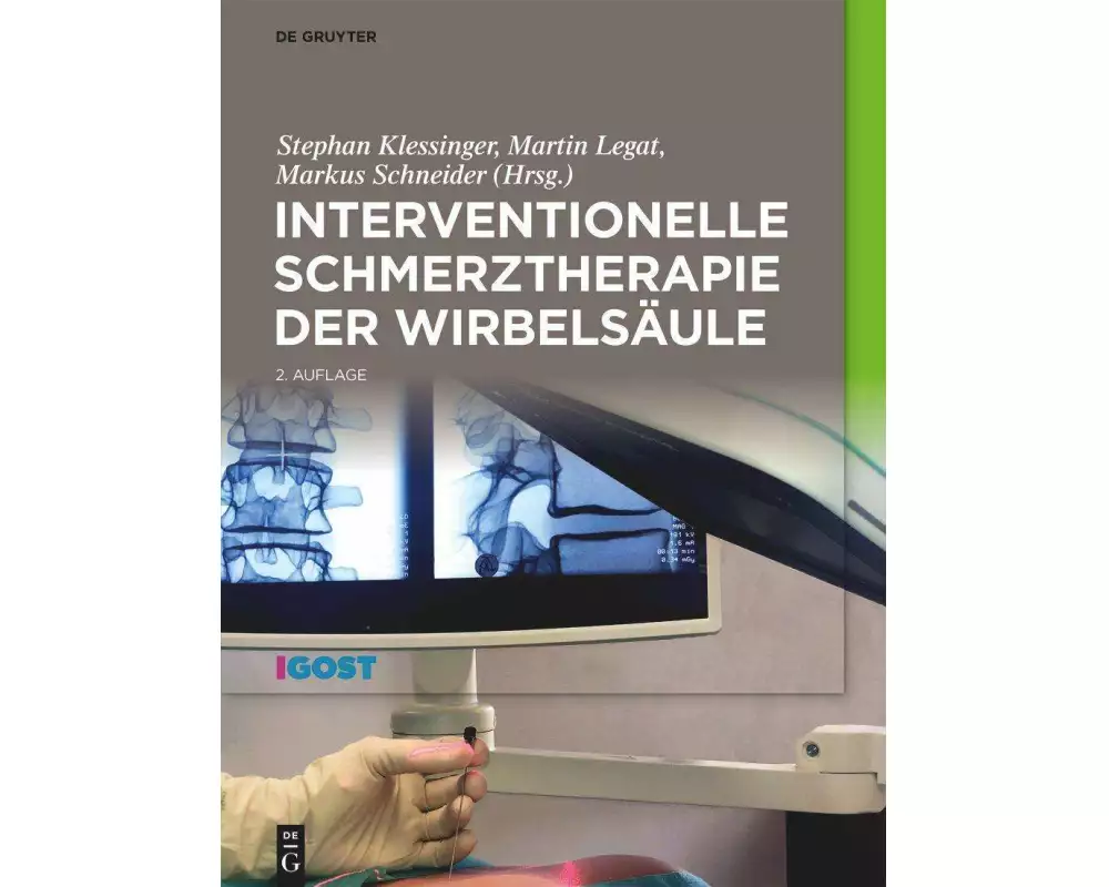 Interventionelle Schmerztherapie der Wirbelsäule