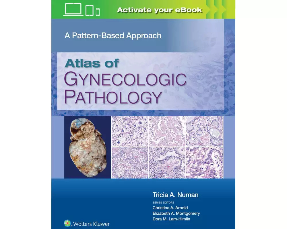 Atlas of Gynecologic Pathology