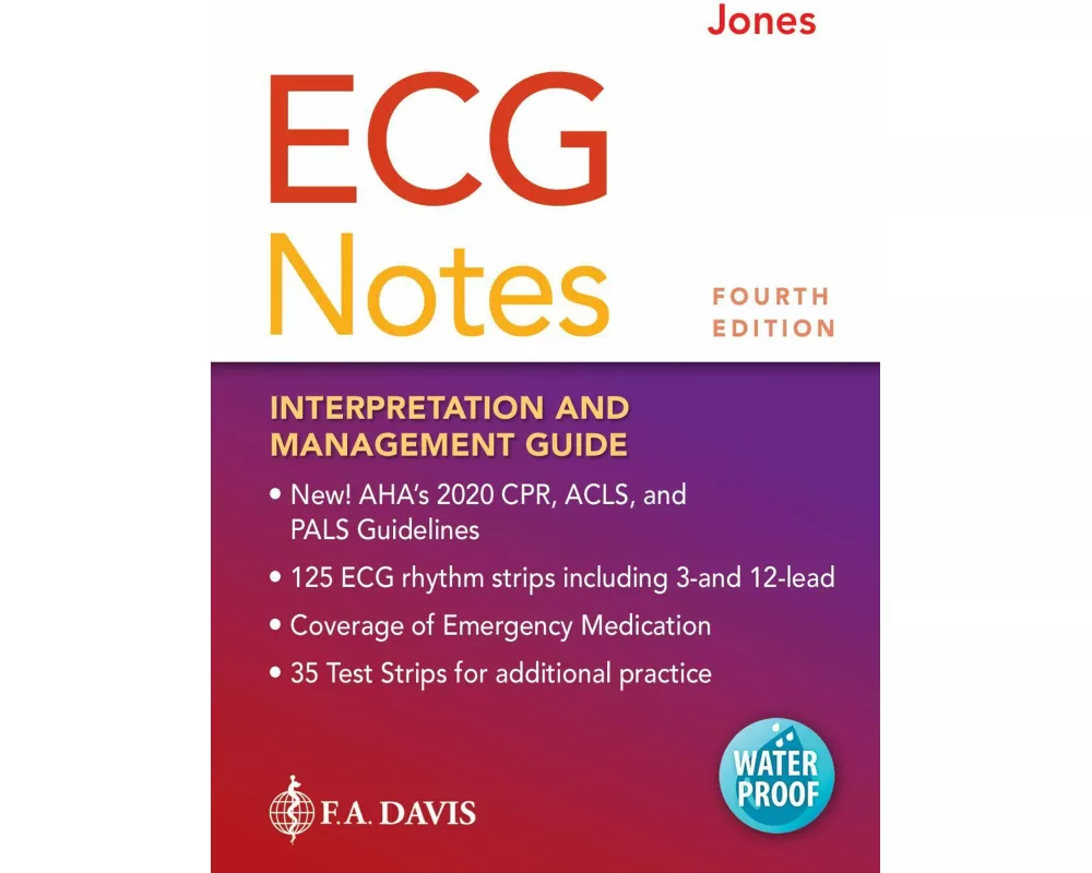ECG Notes