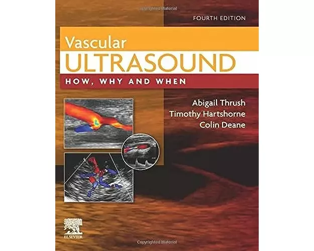 Vascular Ultrasound