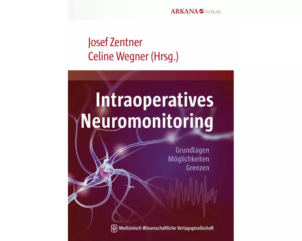 Intraoperatives Neuromonitoring