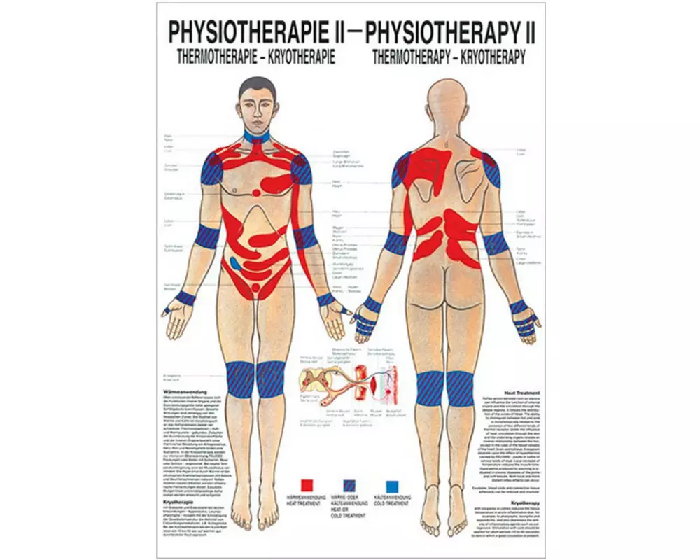 Rüdiger Physiotherapie-Poster Thermo- und Kryotherapie DE/EN