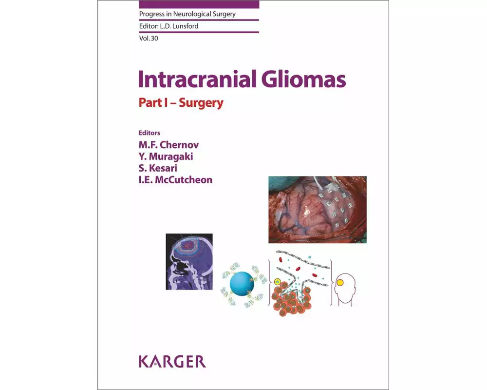 Intracranial Gliomas Part I - Surgery