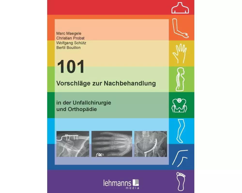 101 Vorschläge zur Nachbehandlung