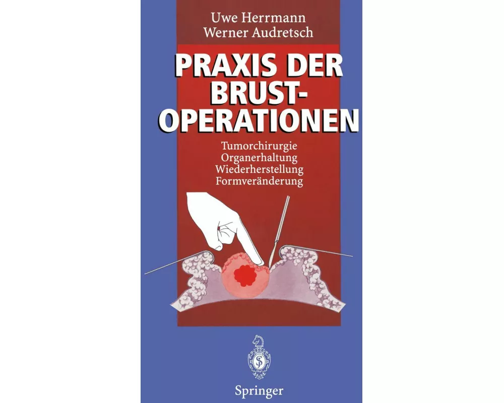 Praxis der Brustoperationen