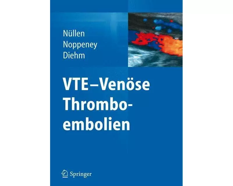 VTE - Venöse Thromboembolien