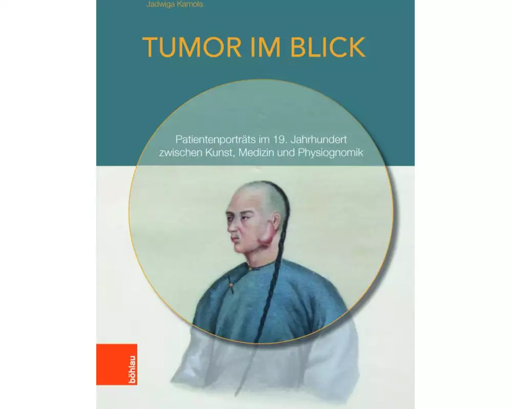 Tumor im Blick