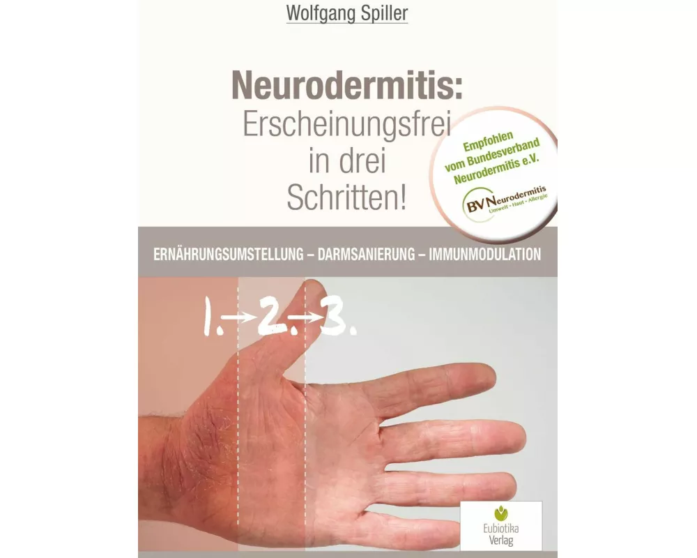 Neurodermitis: Erscheinungsfrei in drei Schritten!