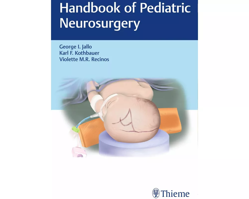Handbook of Pediatric Neurosurgery