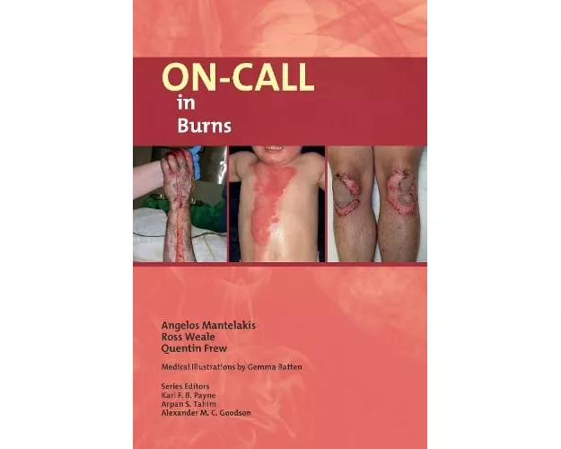On-Call in Burns