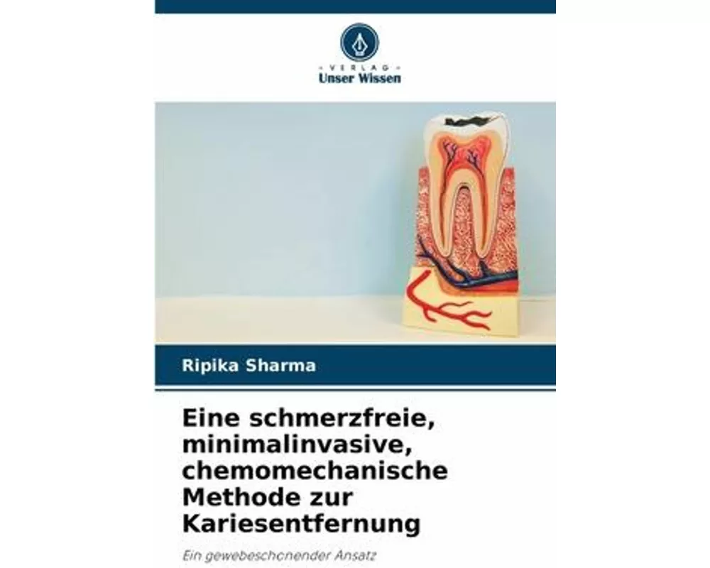 Eine schmerzfreie, minimalinvasive, chemomechanische Methode zur Kariesentfernung