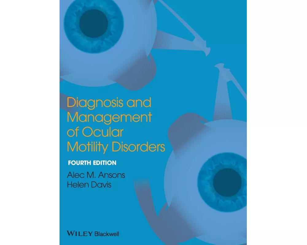 Diagnosis and Management of Ocular Motility Disorders