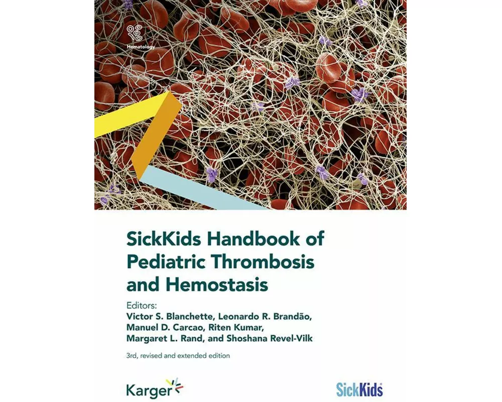 SickKids Handbook of Pediatric Thrombosis and Hemostasis