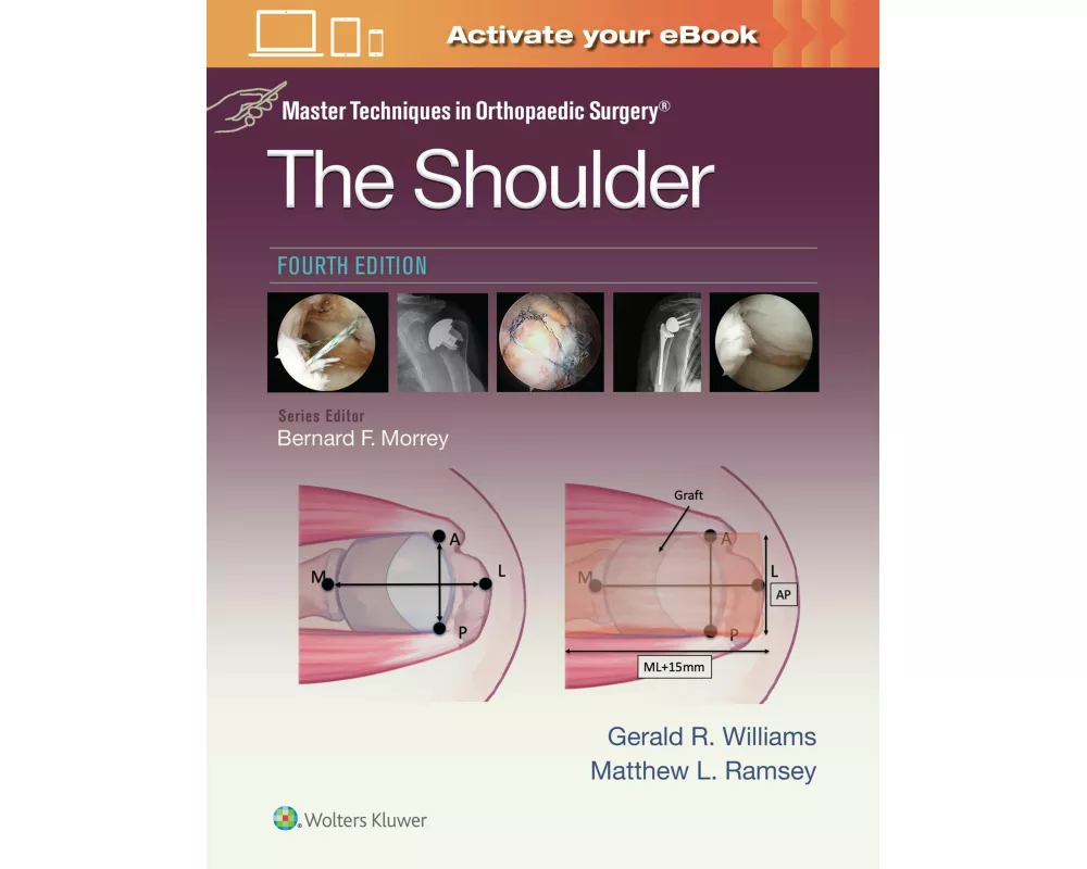 Master Techniques in Orthopaedic Surgery: The Shoulder: Print + eBook with Multimedia