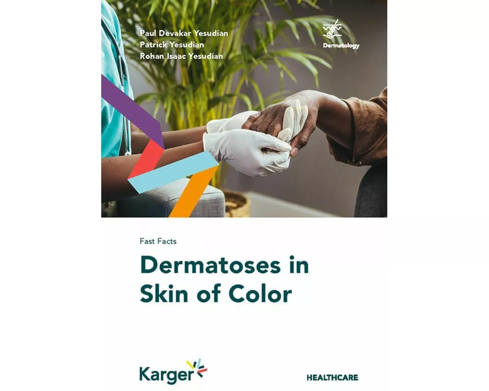 Fast Facts: Dermatoses in Skin of Color