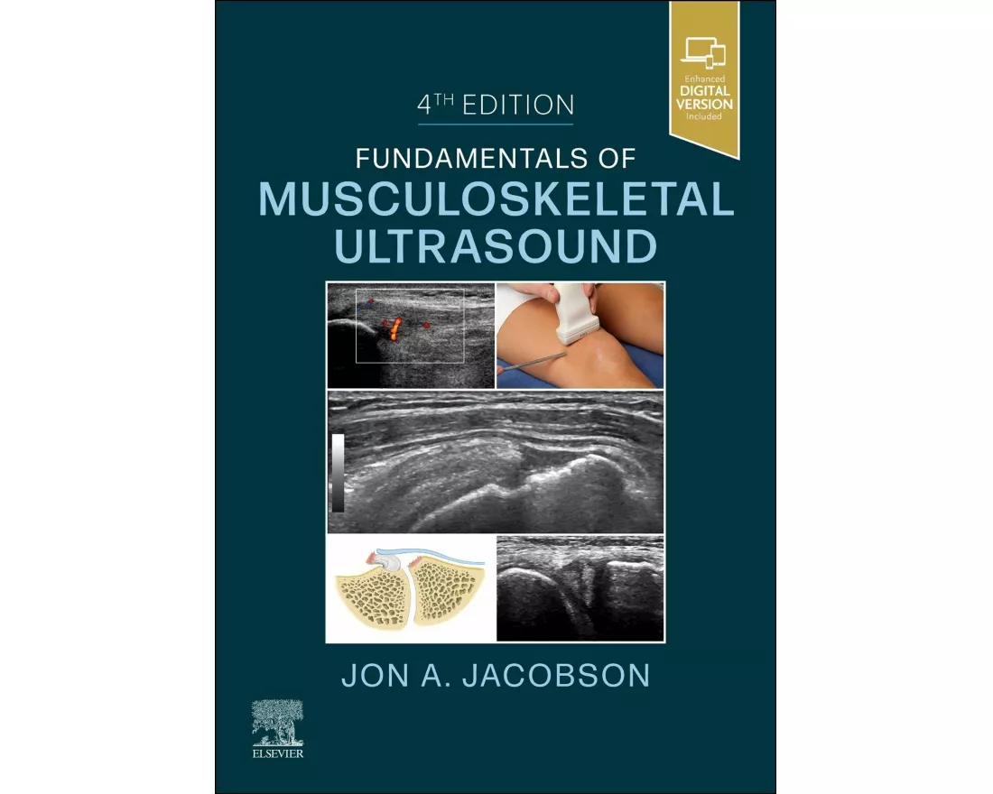 Fundamentals of Musculoskeletal Ultrasound