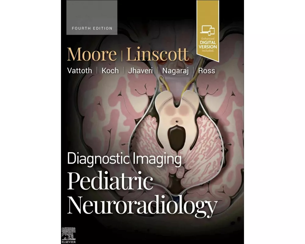 Diagnostic Imaging: Pediatric Neuroradiology