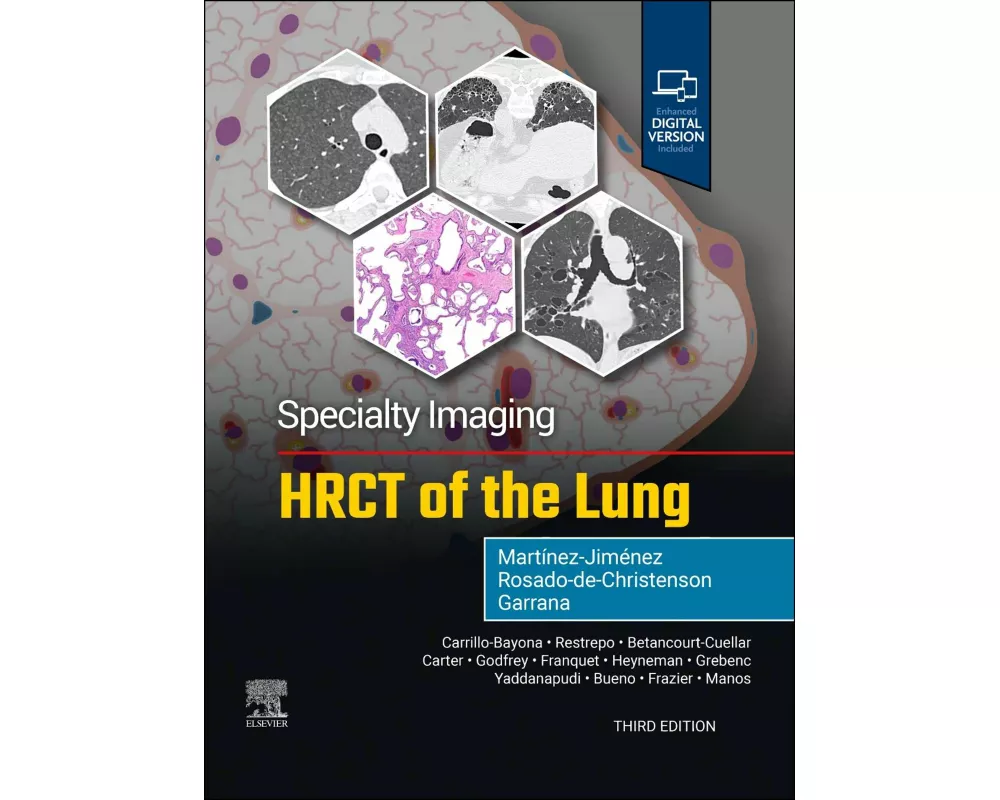 Specialty Imaging: HRCT of the Lung
