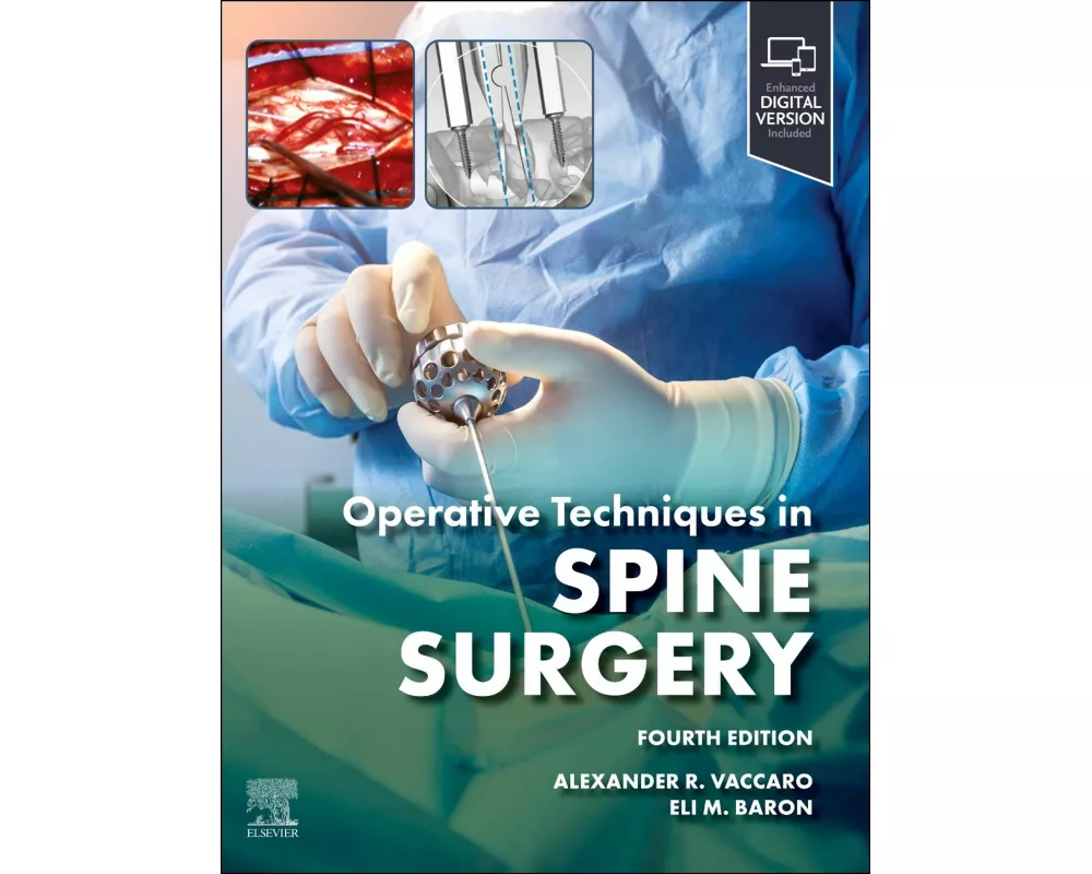 Operative Techniques: Spine Surgery