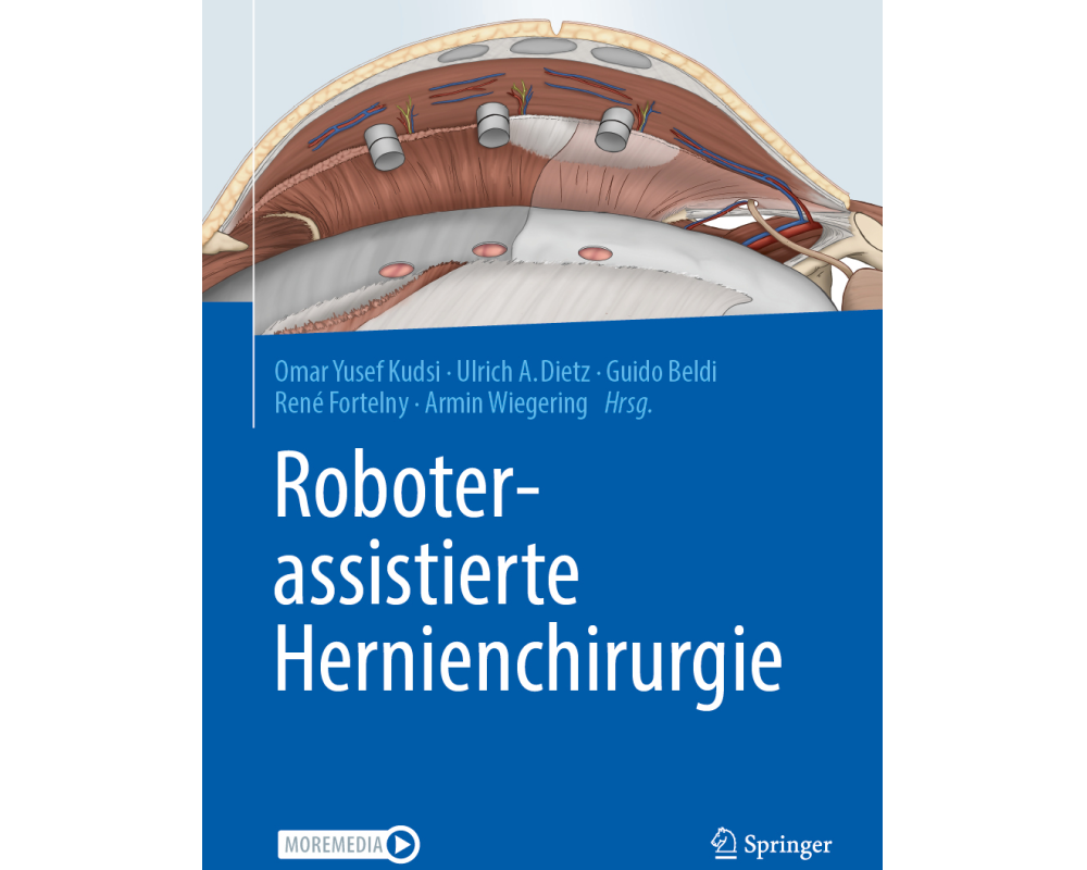 Roboterassistierte Hernienchirurgie