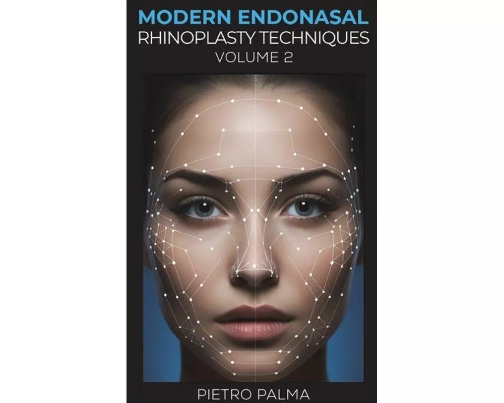 Modern Endonasal Rhinoplasty Techniques – Volume 2
