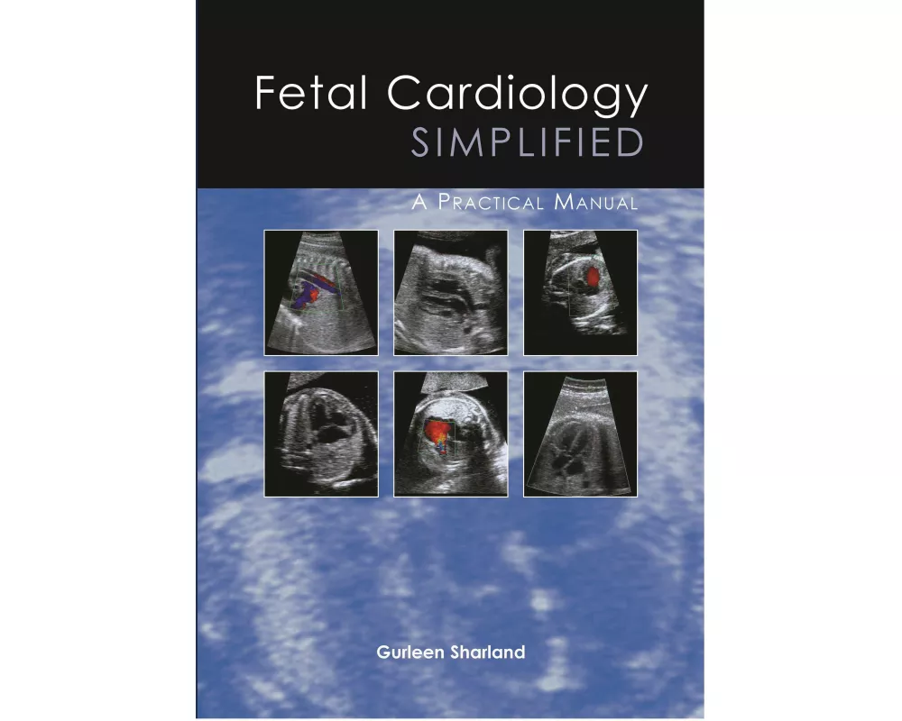 Fetal Cardiology Simplified: A Practical Manual