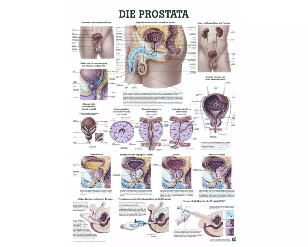 Rüdiger Anatomische Lehrtafel Prostata 70 x 100 cm