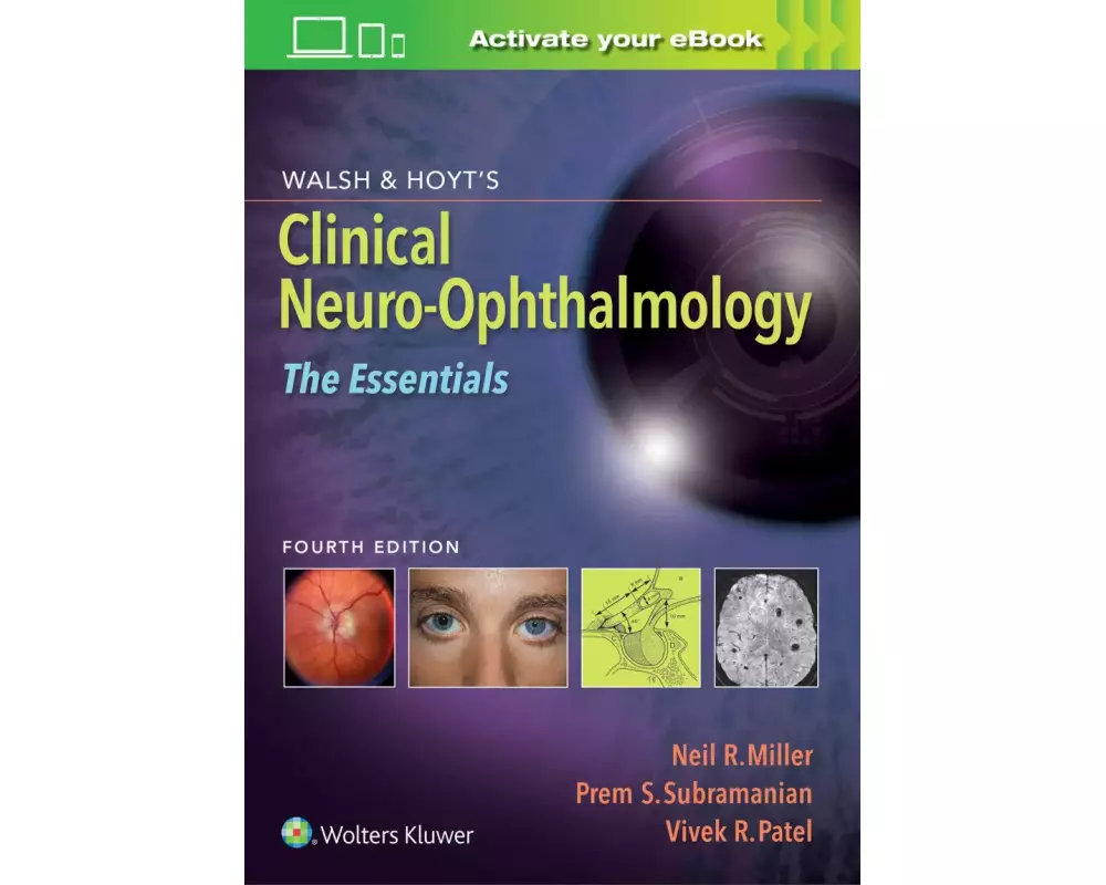Walsh & Hoyt's Clinical Neuro-Ophthalmology: The Essentials