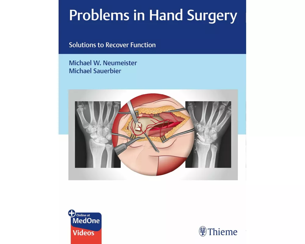 Problems in Hand Surgery