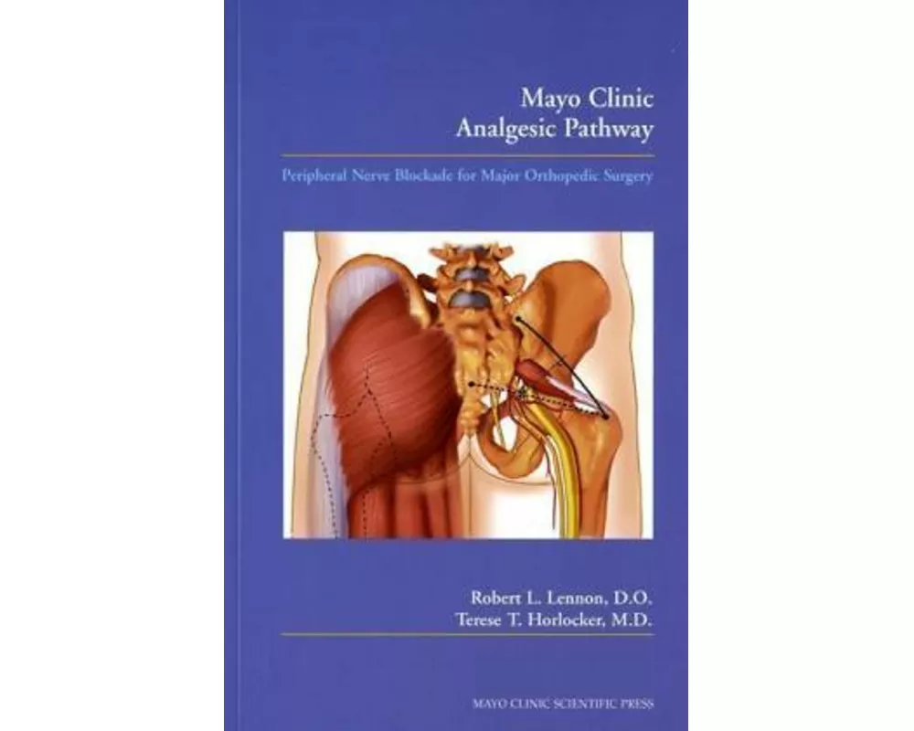 Mayo Clinic Analgesic Pathway