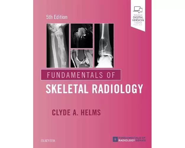 Fundamentals of Skeletal Radiology