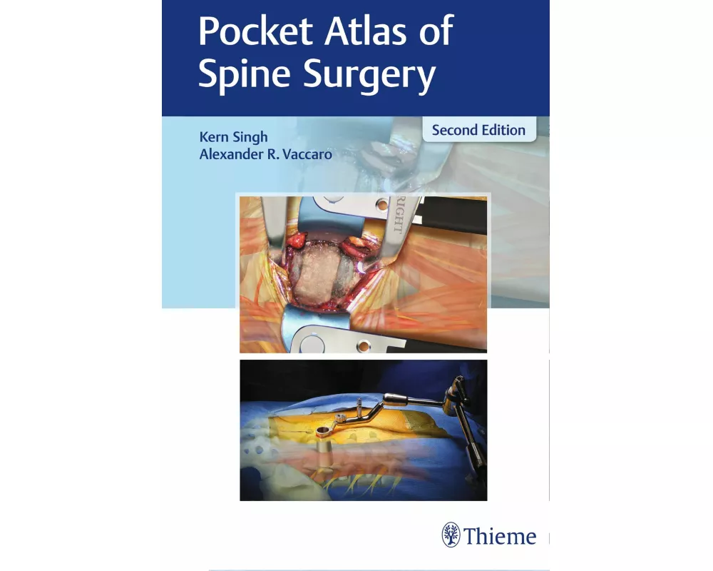 Pocket Atlas of Spine Surgery