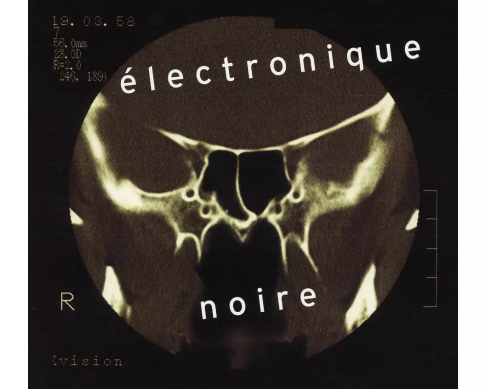 Electronique Noire