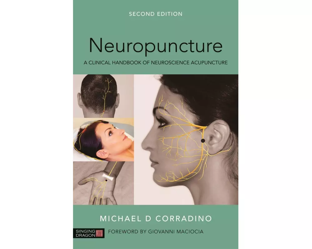 Neuropuncture
