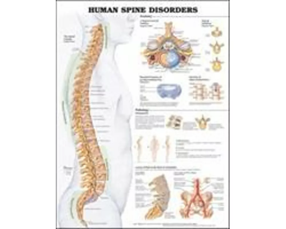 Human Spine Disorders Anatomical Chart