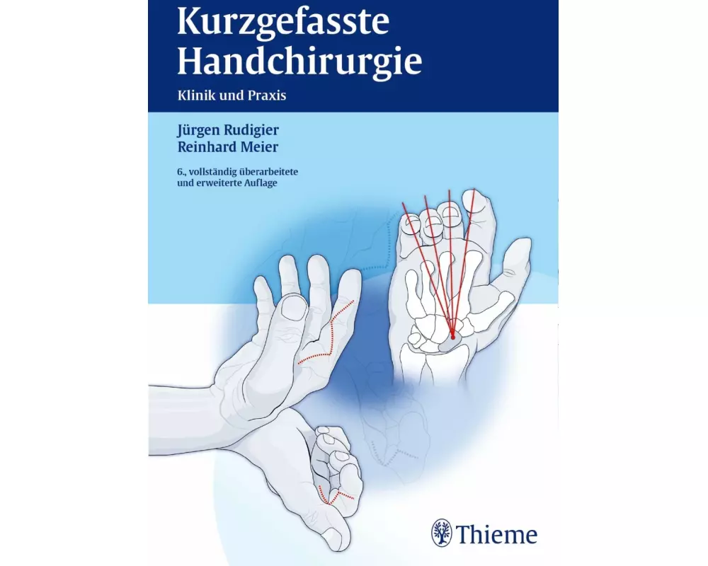 Kurzgefasste Handchirurgie