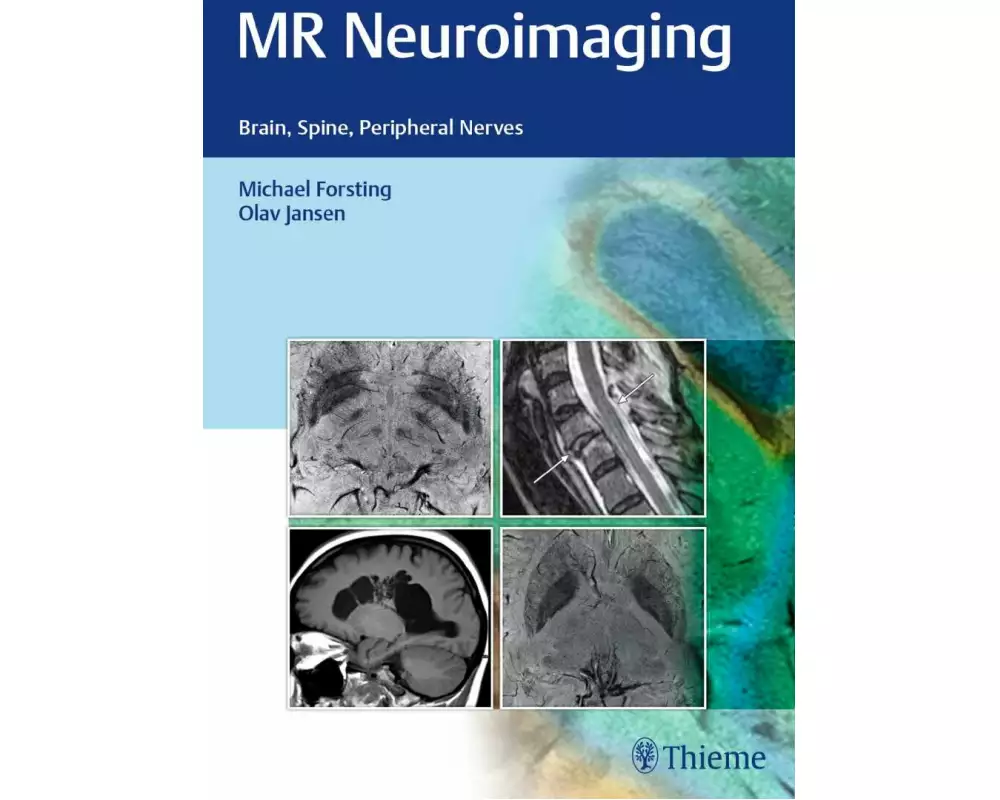 MR Neuroimaging
