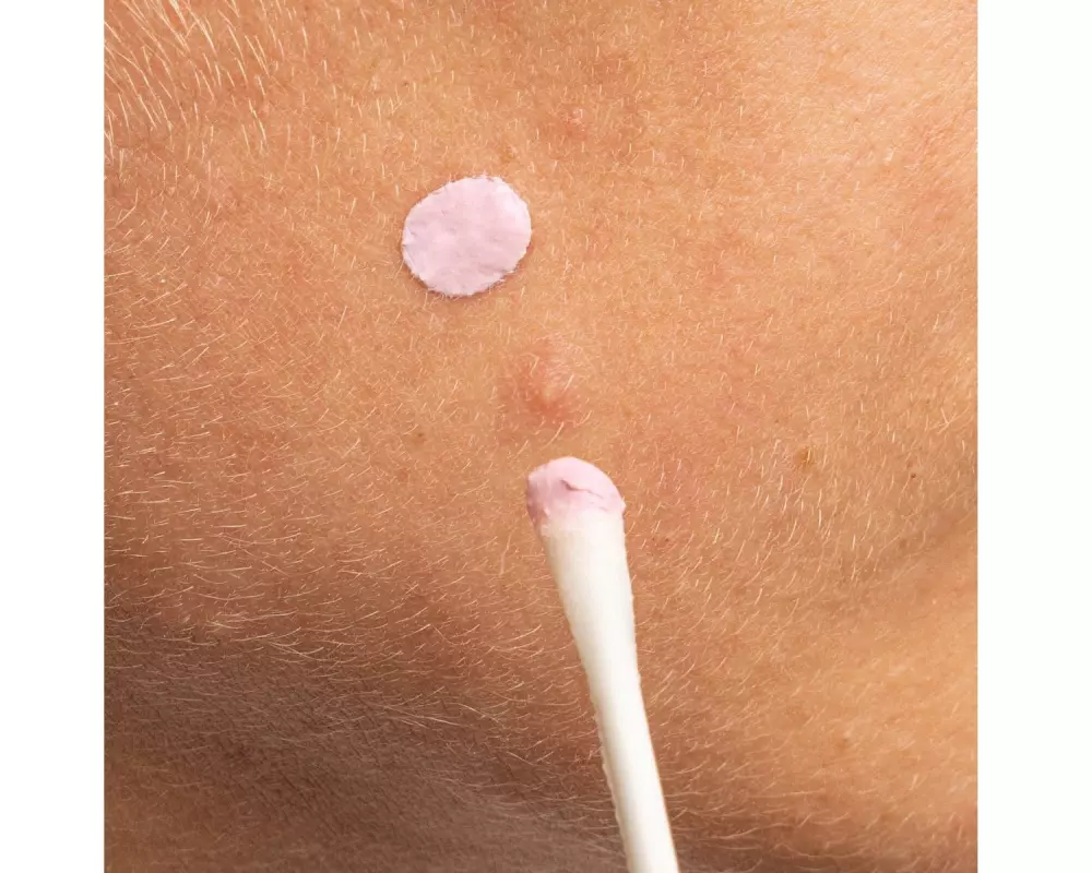 MIZON Pink Spot Good Bye Blemish Overnight Spot Care 19 ml