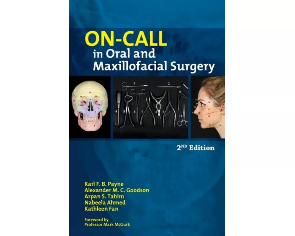 On-Call in Oral and Maxillofacial Surgery