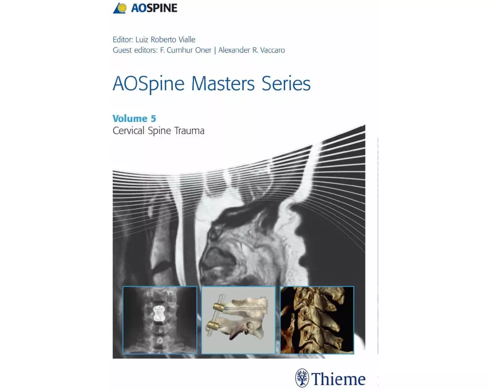 AOSpine Masters Series, Volume 5: Cervical Spine Trauma