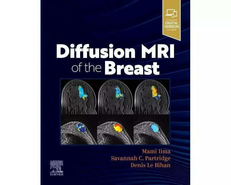 Diffusion MRI of the Breast