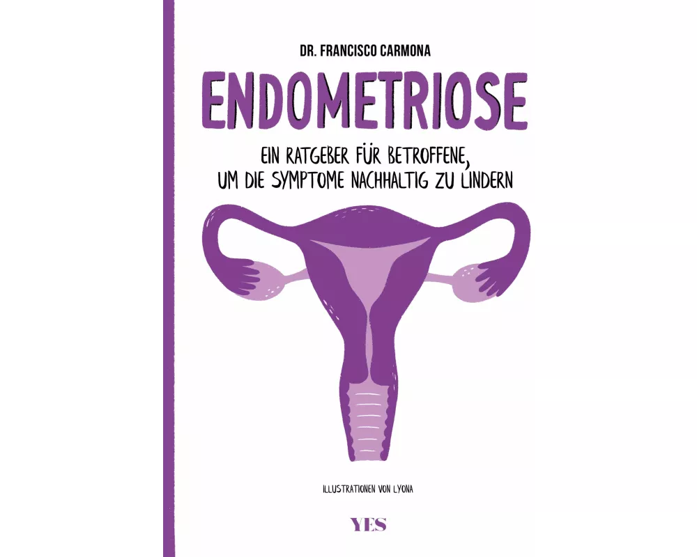 Endometriose